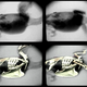 Illustration for article titled CTX Imaging Shows 3D Bones In Fast Motion, Total Recall Style